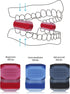 Jaw Exerciser for Men and Women, Food Grade Silicone, Tightening, Shaping, and strengthening Facial Exercise Equipment, Suitable for Beginners, In...