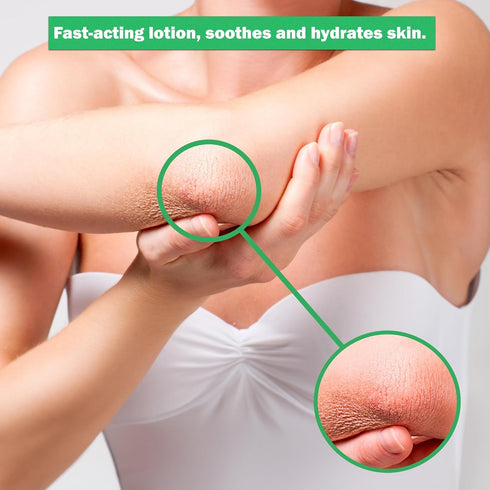 Dr. Dan's Hydrocortisone Hand and Body Lotion- 3 Pack- Anti Itch Lotion for Men and Women...