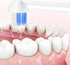 Replacement Tips for Water Flosser Classic Jet Tips Replacement Parts and Oral Irrigators,8 Counts...