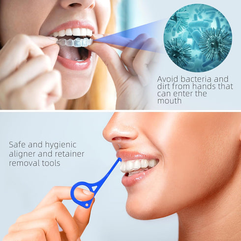 Aligner Removal Tool, 5 Invisible Braces Removal Tools, Retainer Remover Tool, Suitable for Removing Braces, Trays, Retainers, Dentures and Aligne...