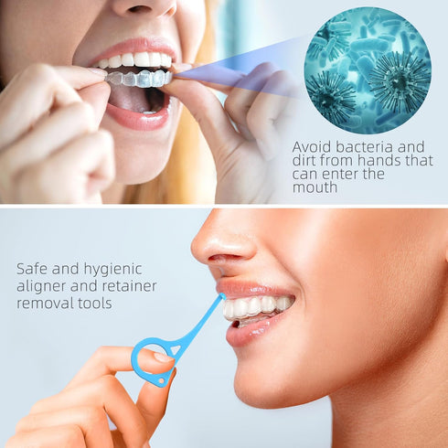 Aligner Removal Tool, 20 Invisible Braces Removal Tools, Retainer Remover Tool, Suitable for Removing Braces, Trays, Retainers, Dentures and Align...