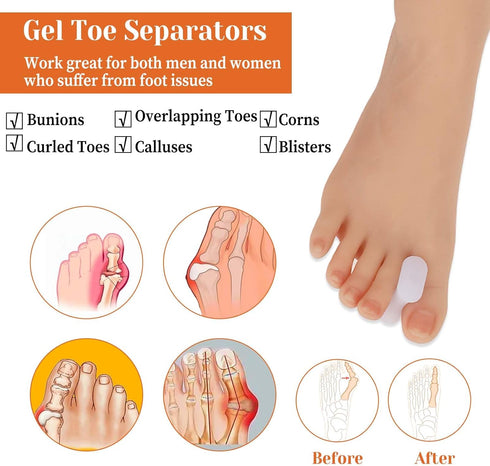 12Pcs Gel Toe Separators Soft Toe Spacers Bunion Corrector Pads Overlapping Toes Orthotics for Men Women Sports Activities Calluses Crooked Toes H...