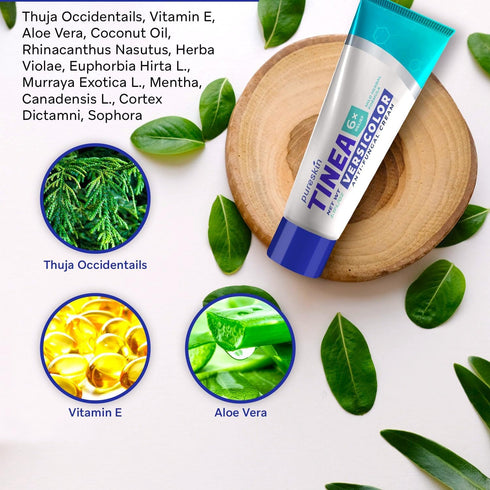 Tinea Versicolor Treatment Antifungal Cream: Extra Strength Natural Anti Fungal Anti Itch - for Tinea Versicolor Ringworm Athlete's Foot Jock Itch...
