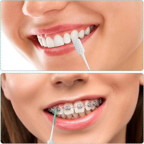 Soft Silicone interdental Brush, Braces Brush, Corrective interdental Brush, Adaptive interdental Brush, Disposable interdental Brush, Suitable fo...