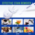 VieBeauti Teeth Whitening Kit - 5X LED Light Tooth Whitener with 35% Carbamide Peroxide, Mouth Trays, Remineralizing Gel and Tray Case - Built-in ...