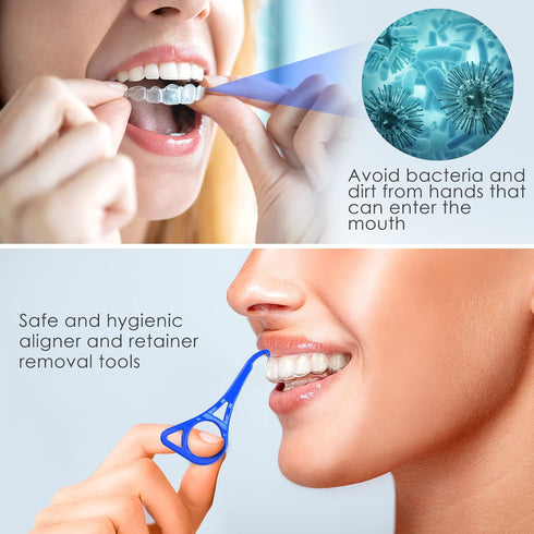 Aligner Removal Tool, 5 Retainer Remover Tool, Invisible Braces Removal Tools, Suitable for Removing Braces, Trays, Retainers, Dentures and Aligne...