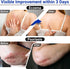 Eczema Cream, Maximum Strength Treatment Ointment for Rash, Psoriasis, Dermatitis, Urticaria, Jock Itch, Fungal Infection, Anti-Itch, Relief for S...