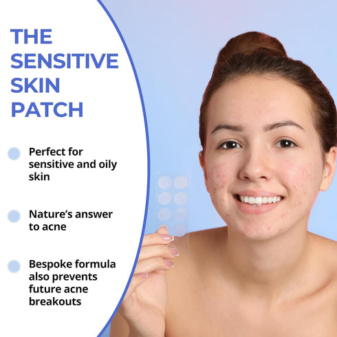 The Sensitive Skin Patch (48 Patches) | Bespoke Formula Pimple Patches for Face | Clear Skin, Gentle Touch | Results After 6 Hours | Strategically...