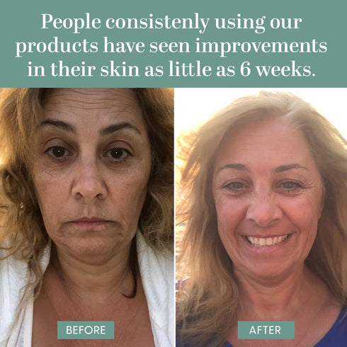 Ceramide and Peptide ageless Cream, Daily Facial Repair Moisturizing Cream, Skincare, Moisturizer, Safe for Sensitive Skin, Vegan, Gluten-Free...
