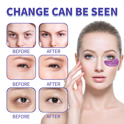Under Eye Patches (28 Pairs) - Under Eye Mask for Puffy Eyes, Dark Circles, Puffiness, Bags and Wrinkles, 7 Colors Crystal Gel 24K Gold Eye Mask, ...