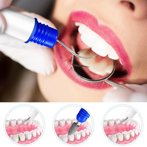 Healvian 2pcs Portable Dental Picks Teeth Stain Remover Mini Travel Plaque and Tartar Remover with Chain Mini Stain Eraser Oral Cleaning Tools for...