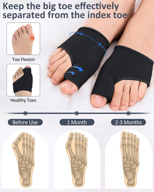2 Pcs Bunion Corrector for Women Men Bunion Pain Relief, Big Toe Straighteners, Breathable Bunion Correction Socks with Built-in Gel Pad, Big Toe ...