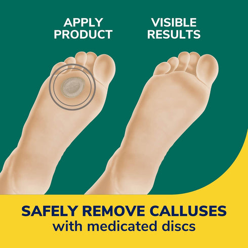 Dr. Scholl's Extra Thick Callus Remover, 4ct // Helps Soften Hard Calluses and Cushions for All-Day Pain Relief...