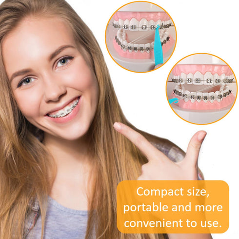 50 Pcs Colorful Dental Elastic Braces Rubber Band Tool for Orthodontic Braces...