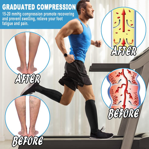 Bacophy 2 Pairs Zipper Compression Calf Socks 15-20 mmHg Open Toe Women Men...