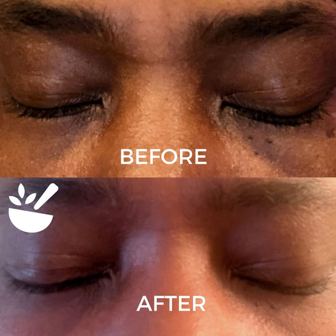 Face Moisturizer for Sensitive Skin Face Moisturizer for Women Hydrating Face Moisturizer Unscented Sensitive Skin Moisturizer Mens Face Moisturiz...