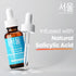 SeoulCeuticals Korean Acne Serum, Skin Care Treatment for Acne Prone Skin - Rapid Action Salicylic Acid, Tea Tree & Clove For Even Skin Tone 1oz...