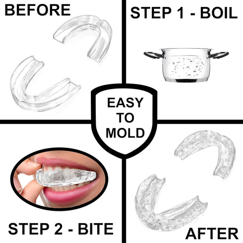 Small Mouth Guard for Women – 2 Sizes, Custom Fit, Non-Bulky, Moldable – (4) Mouth Guards for Teeth Grinding & Case – Comfortable Mouthguard, Dent...