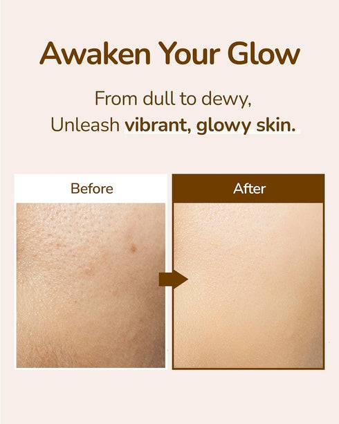 Skin-Balancing Oil Mist (3.4fl oz x 2ea) - Soothes, Moisturizes & Balances Skin. Sea Buckthorn, Hyaluronic Acid - Korean Skin Care...