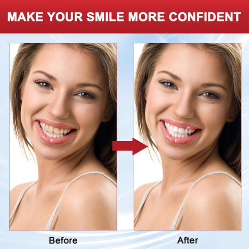 Sp8 Probiotic Toothpaste, Sp-8 Super Whitening Toothpaste, Fresh Breath Removes Tartar, Deep Cleans The Mouth, Care Toothpaste (2PCS)...