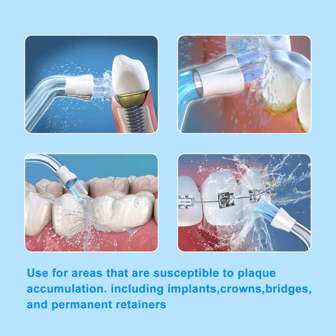 Flosser Replacement Tips for Waterpik Water Flosser,Plaque Seeker Replacement Tips Compatible with Waterpik Water Flossers and Other Brand Oral Ir...