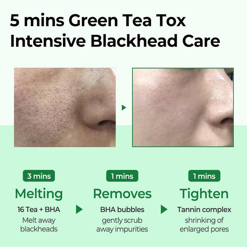 SOME BY MI Bye Bye Blackhead 30 Days Miracle Green Tea Tox Bubble Cleanser - 4.23 Oz, 120g - Made from Green Tea Extract - Mild Daily Face Wash fo...