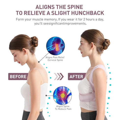 Posture Corrector For Women, Adjustable Back Brace For Posture, Back Posture Corrector Providing Pain Relief From Lumbar, Neck, Shoulder, And Clav...