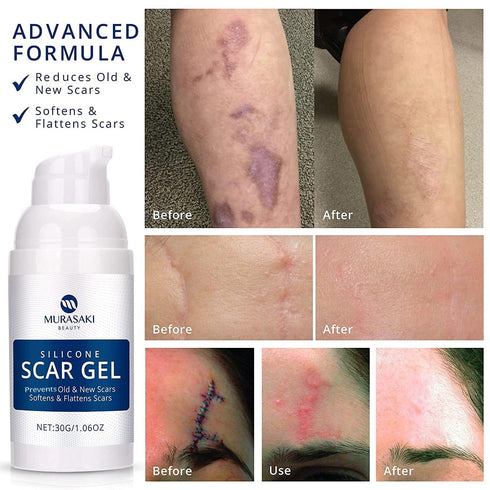 100% Silicone Scar Gel Scar Cream - Advanced Scar Gel for Surgical Scars, C-Section, Stretch Marks, Acne, Injury, Burns, Keloids, Old and New Scar...