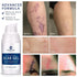 100% Silicone Scar Gel Scar Cream - Advanced Scar Gel for Surgical Scars, C-Section, Stretch Marks, Acne, Injury, Burns, Keloids, Old and New Scar...