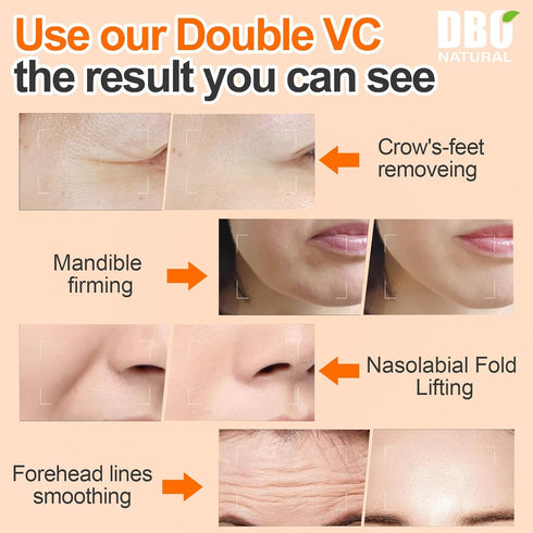 Vitamin C Face Serum With Hyaluronic Acid, Hydrating, Anti-Aging, Brightening, Blemishing For Face Glowing.30ml Natural Ordinary Serum For Day/Nig...