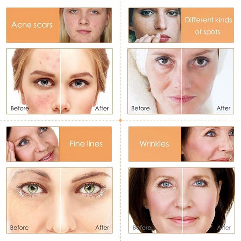 Skin Care Set ,Vitamin C Facial Serum Care Set ,Skin Care Routine Kit -Cleanser, Face Serum, Face Cream,Toner, Eye Cream,Anti- Aging Skin Care Set...