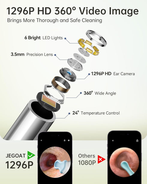 Ear Wax Removal Tool Camera, Ear Cleaner with Camera, Ear Cleaning Kit 1296P HD Ear Scope and 6 LED Lights, 10 Ear Pick Tips, Earwax Removal kit w...