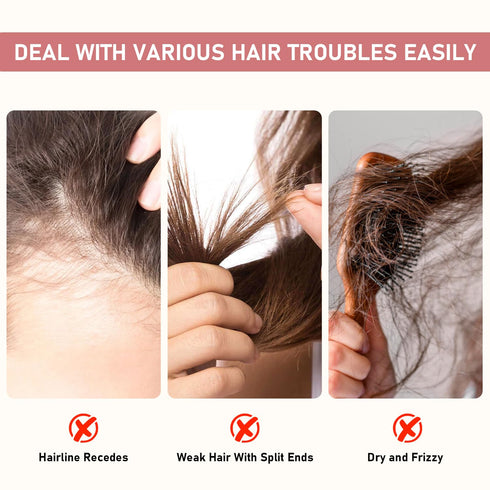 Bello Hair Helper Spray for Thinning Hair, Hair Helper Growth Spray, Hair Growth Spray, Rice Water Spray, Hair Thickening Natural Spray, Restore D...