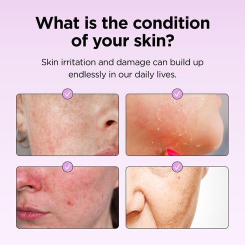 Superfood for Skin Hyalusteen Repair Toner - Facial Hydrationg toner/Korean Skincare Soothing Toner for Face (5.07fl.oz, 150ml)...