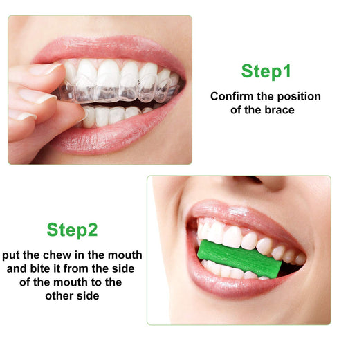 10 Pieces Aligner for Aligner Chompers Aligner Trays Seater Orthodontic Dental aligner(Green)...