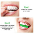 20 Pieces Aligner Tray Seaters for Aligner Trays Chompers Orthodontic Trays(Green)...