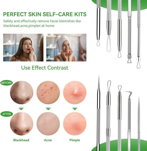 Pimple Popper Tool Kit,Blackhead Remover Tool 5 Pcs Blackhead Extractor Tool for Face Comedone Zit Acne Whitehead Blemish, Stainless Steel Extract...