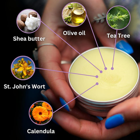BenePura Calendula Ointment - Natural Calendula Cream for Burns, Cuts, Scrapes and Wounds - Calendula Salve for Dry Skin - Burn Cream, Burn Ointme...