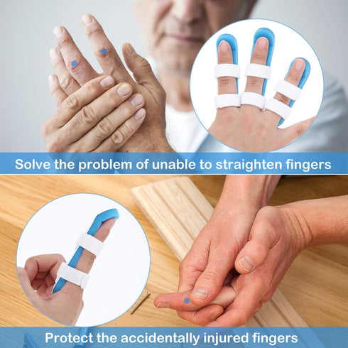 BBTO 10 Pieces Finger Splint Metal Finger Support Knuckle Stabilizer with Soft Foam Interior and Protective Vent, 3 Sizes(Blue,10 Pieces)...