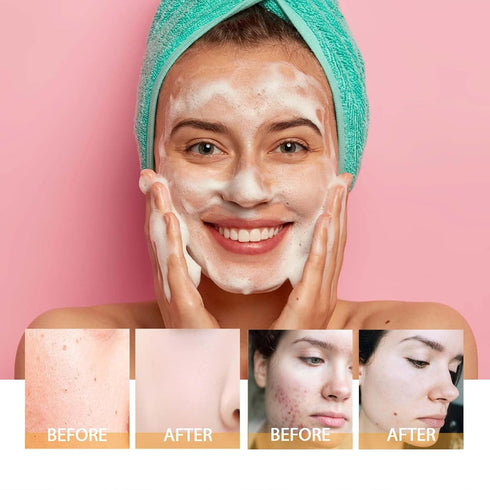 Turmeric Facial Cleanser, Turmeric Foaming Facial Cleanser + Tumeric ??y??lu??o??ic Acid Serum, Face Skincare Deep Cleaning Moisturizing for All S...