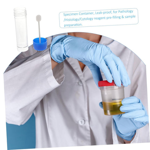 Human and Dog Stool Sample Container with Spoon Lid - 10 Pack - 25-30ml Urine and Fecal Specimen Cups with Screw-On Lids - Ideal for Medical and L...