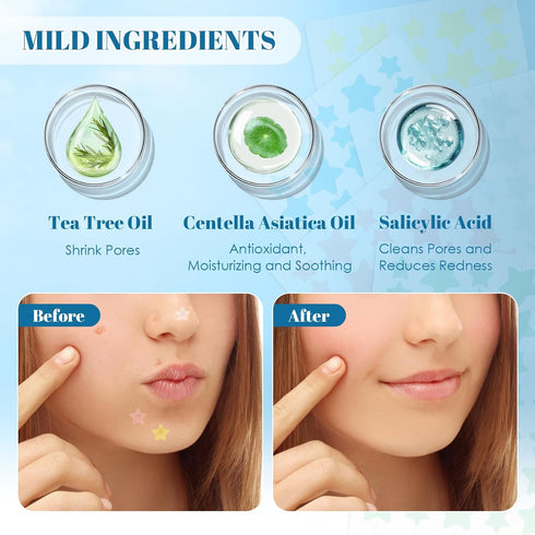 PITHER Pimple Patches for Face, Acne Patches Cute Star Zit Patches Covers for Skin Care, Hydrocolloid Spot Stickers Contain Centella Asiatica, Tea...