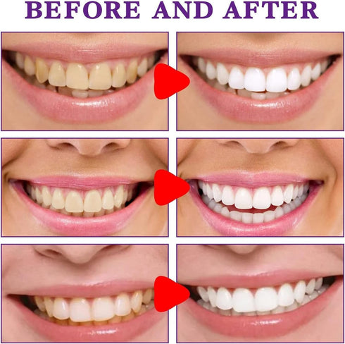 SP-8 Ultra Whitening Toothpaste,Sp8 Brightening Toothpaste,Sp-8 Toothpaste Fresh Breath,Brightening & Stain Removing Toothpaste (2PCS)...