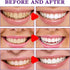 SP-8 Ultra Whitening Toothpaste,Sp8 Brightening Toothpaste,Sp-8 Toothpaste Fresh Breath,Brightening & Stain Removing Toothpaste (2PCS)...
