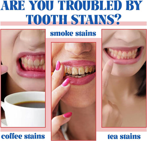 2PCS Nicotinamide Toothpaste, Bulk Toothpaste,Fresh Breath Toothpaste,Fluoride Free Toothpaste...