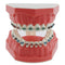 Orthodontic Model Dental Models 1:1 Standard Typodont Teeth Model M7010-2 Demo Teach Study with Archwire Ligature Ties Metal Brackets Buccal Tubes...
