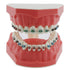 Orthodontic Model Dental Models 1:1 Standard Typodont Teeth Model M7010-2 Demo Teach Study with Archwire Ligature Ties Metal Brackets Buccal Tubes...