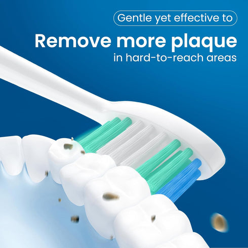 Replacement Toothbrush Heads 10 Pack Compatible with AquaSonic Black Series, Vibe Series, Black Series pro, and Duo Series pro Electric Toothbrush...