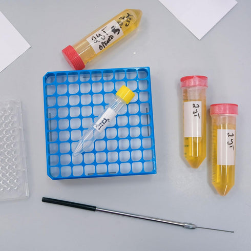 PATIKIL 100 Well Centrifuge Tube Freezer Storage Box, 2 Pcs Polypropylene Lockable Tube Rack for 1.5/1.8/2ML Tubes Vials Samples, Green...