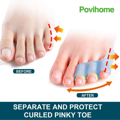 Povihome 10 Pack Pinky Toe Separator and Protectors for Overlapping Toe, Curled Pinky Toes - Spacers for Morton's Neuroma Pain Relief...